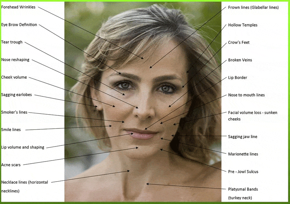 Botox And Dermal Filler Charting