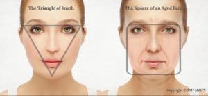 Change in facial shape with aging