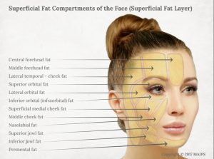 facial aging effects on superficial fat pads