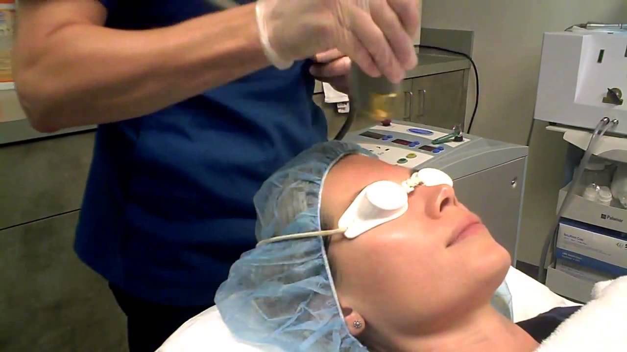 Collagen Plumping With Laser Genesis