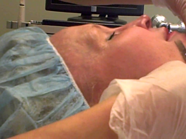 Dermaplaning Removes Peach Fuzz &amp; Dull Skin
