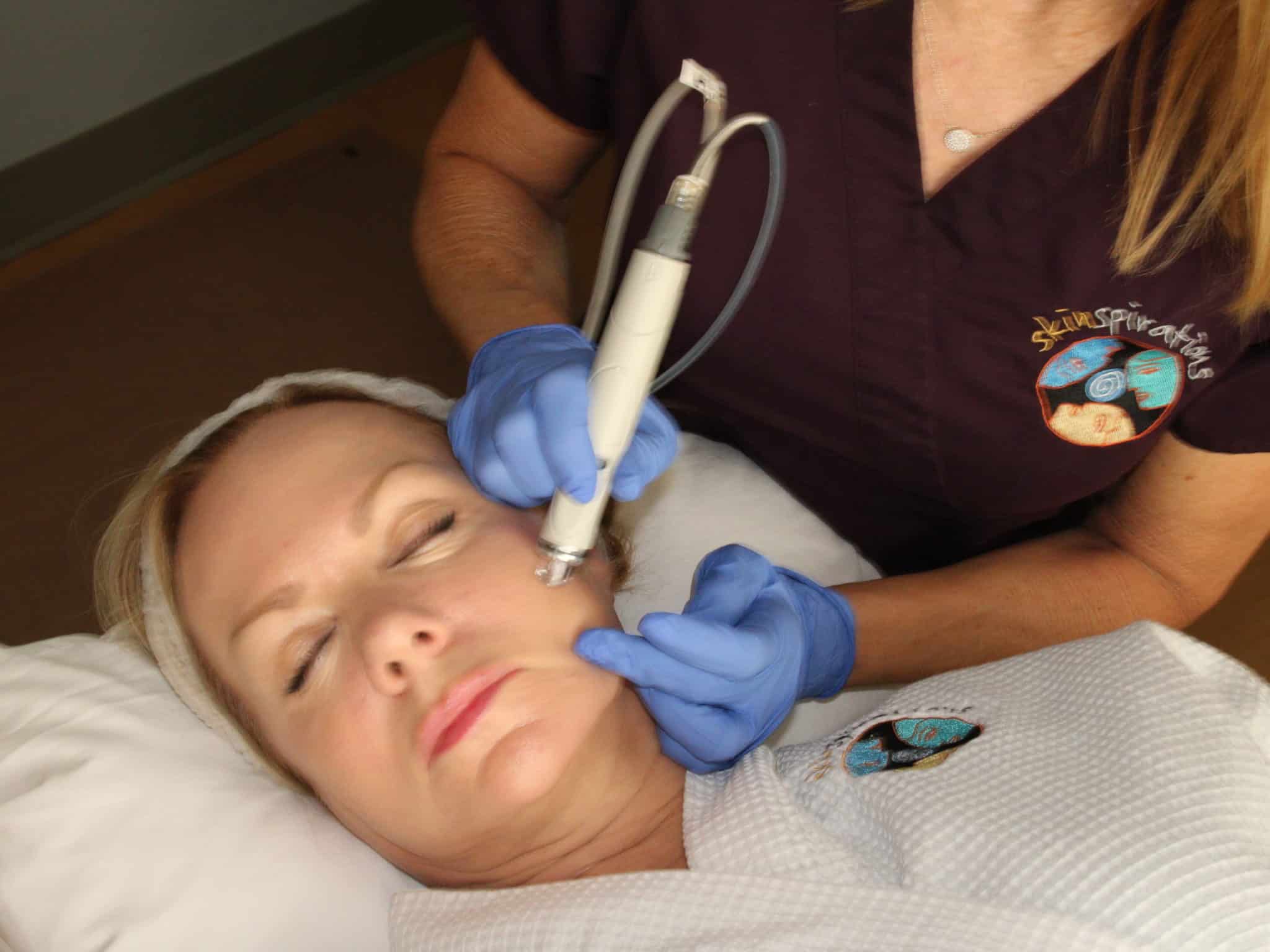 Closeup photo of a microdermabrasion treatment at Skinspirations