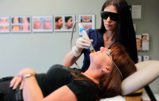 Laser hair removal on the face
